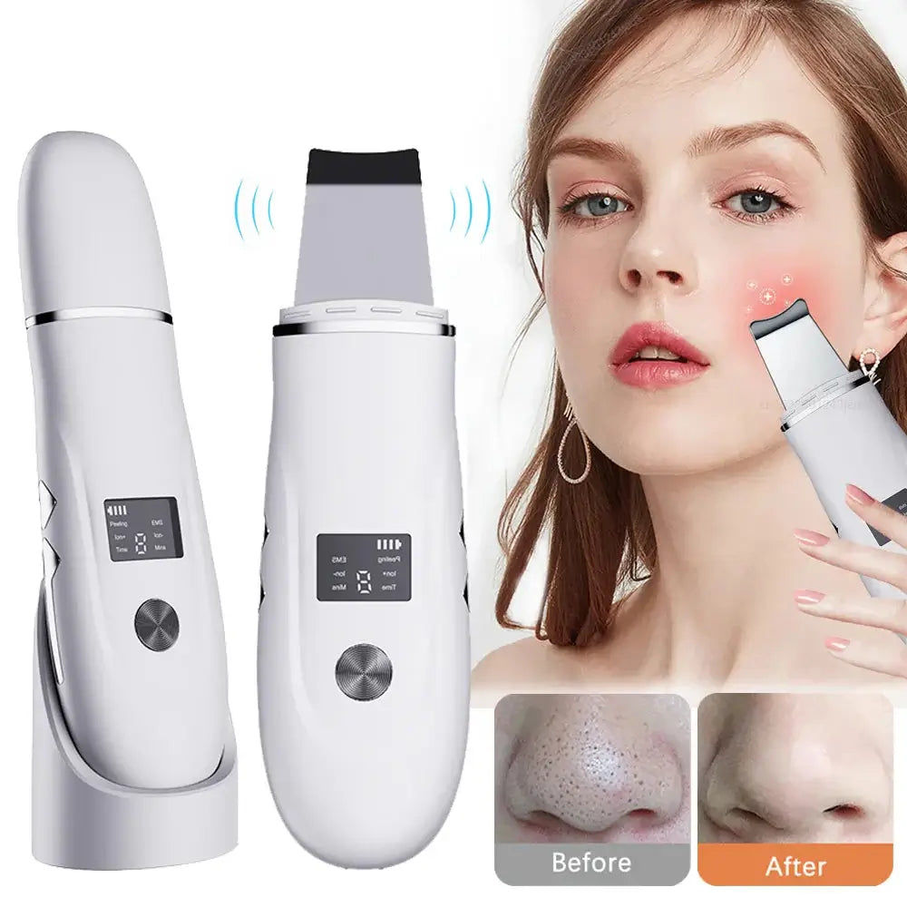 Ultrasonic Scrubber Facial Cleanser   