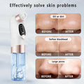 Face Cleaner Blackhead Removal tool